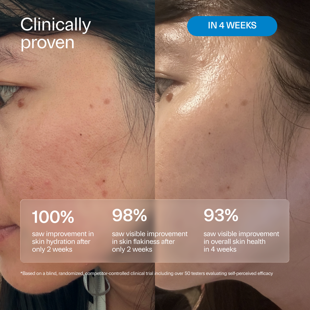 LH2.0 HydrO18 Triple Lipid 2.0% + Linoleic Acid Hydrating Moisturizer