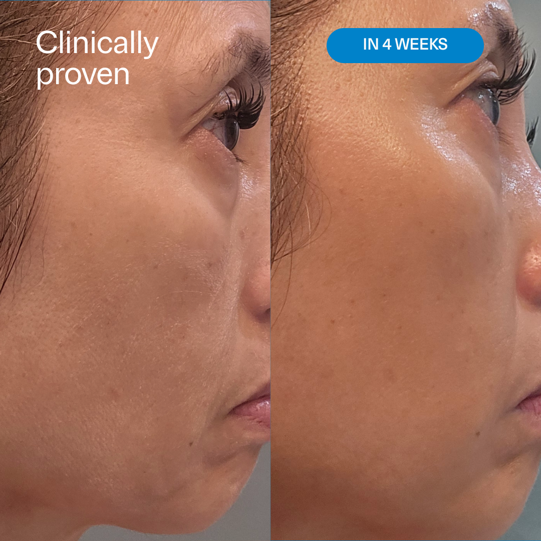 LH2.0 HydrO18 Triple Lipid 2.0% + Linoleic Acid Hydrating Moisturizer
