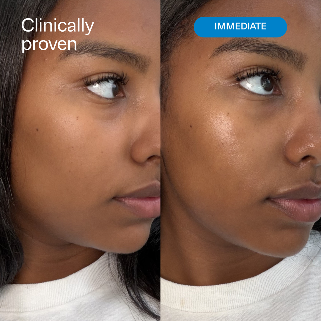 LH2.0 HydrO18 Triple Lipid 2.0% + Linoleic Acid Hydrating Moisturizer