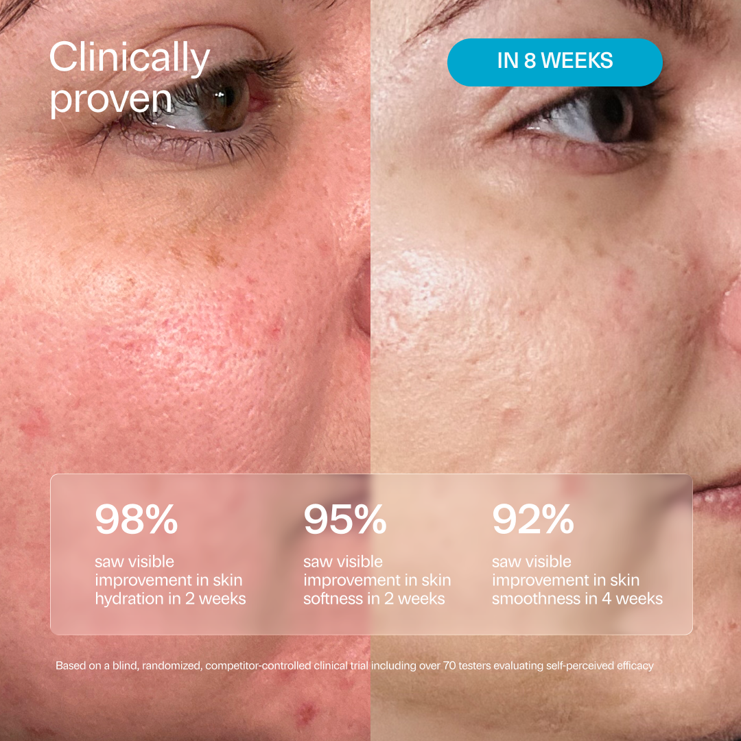 PA5.1 P-hyaluronic Acid 5.1% + Sunflower Hydrating Serum