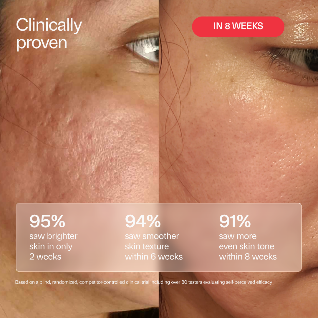 XC15 Pure Vitamin C 15% + Marigold Brightening Serum