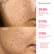 XC15 Pure Vitamin C 15% + Marigold Brightening Serum