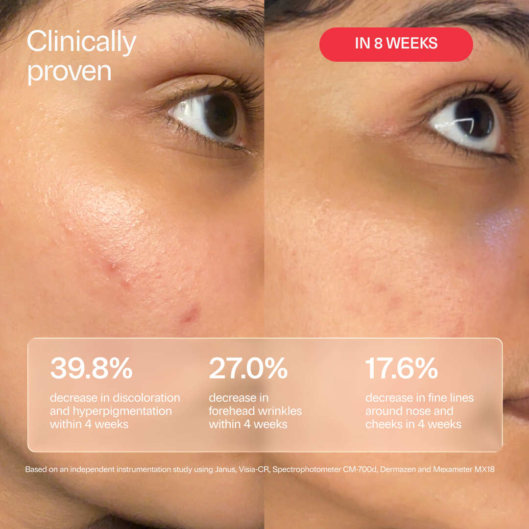XC15 Pure Vitamin C 15% + Marigold Brightening Serum